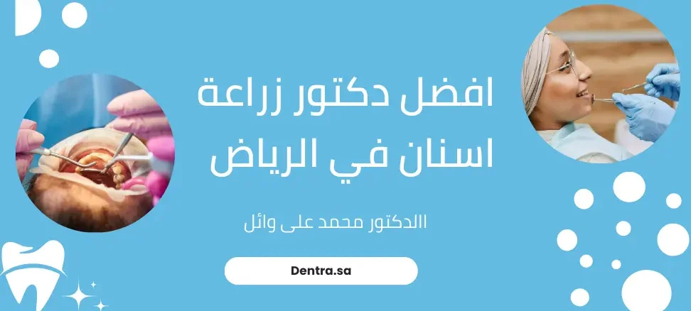 افضل دكتور زراعة اسنان في الرياض السعودية