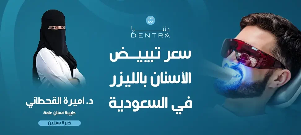سعر تبييض الأسنان بالليزر في السعودية